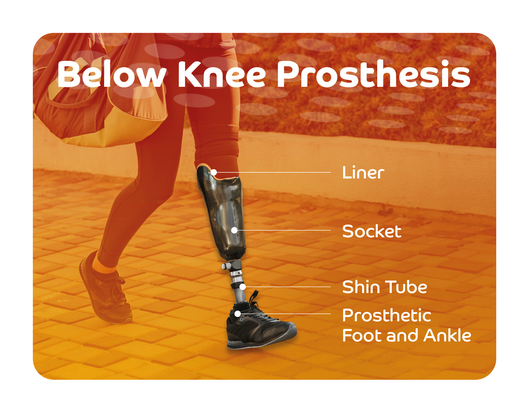 Below Knee Prosthetic Limbs