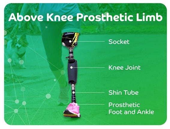 AK Prosthesis Diagram